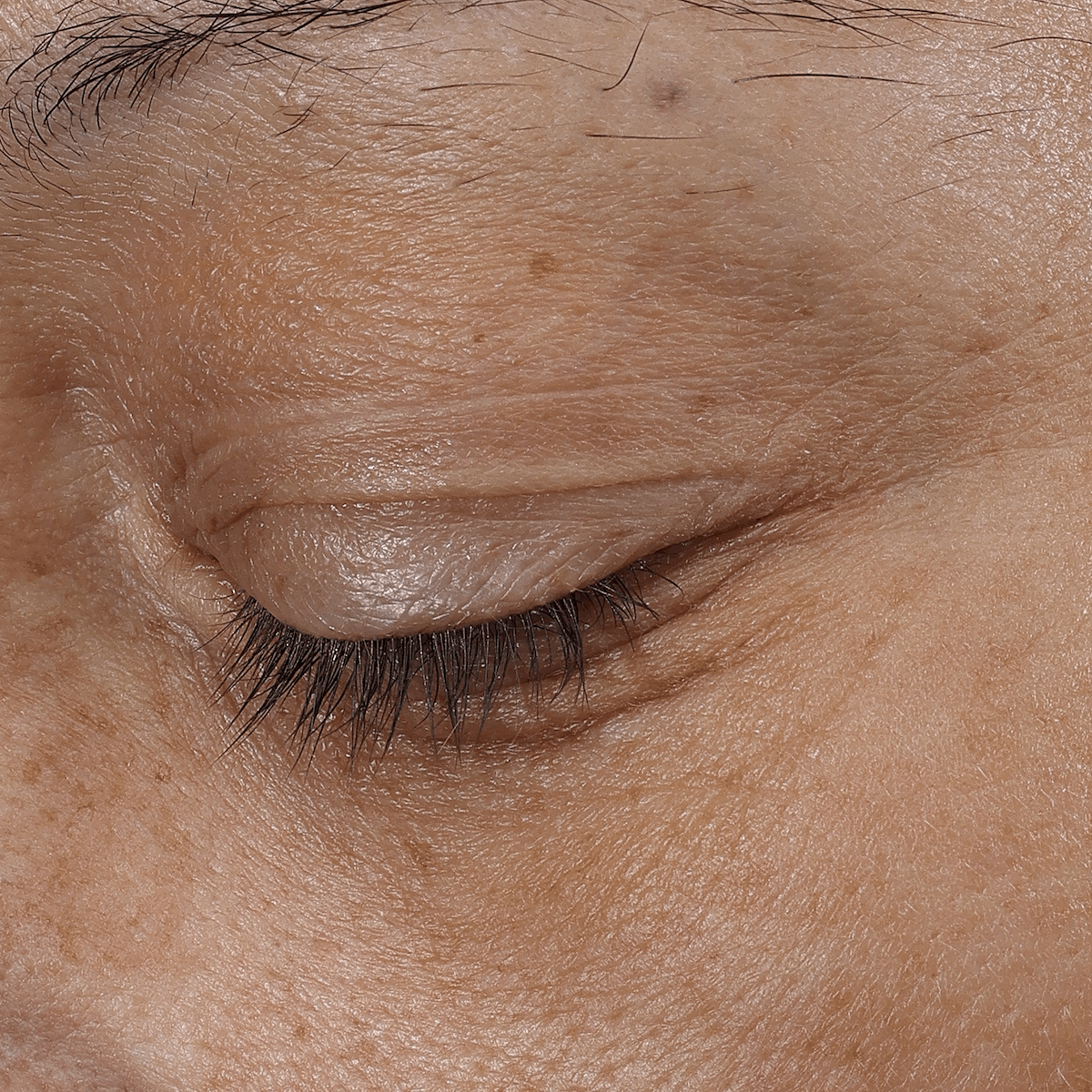 Bio - Renew EGF Eye Cream - Glo Skin Beauty UK&I