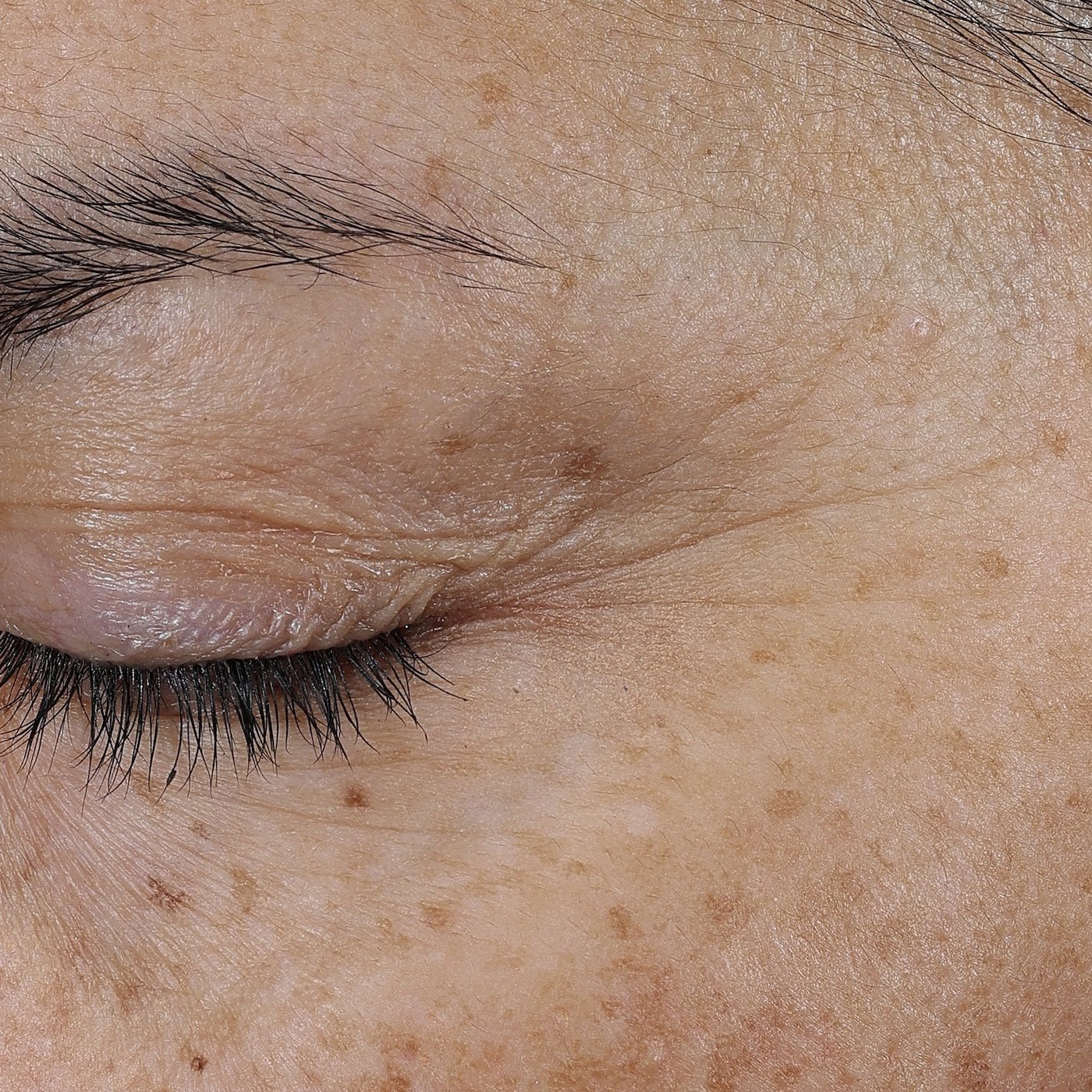 Bio - Renew EGF Eye Cream - Glo Skin Beauty UK&I