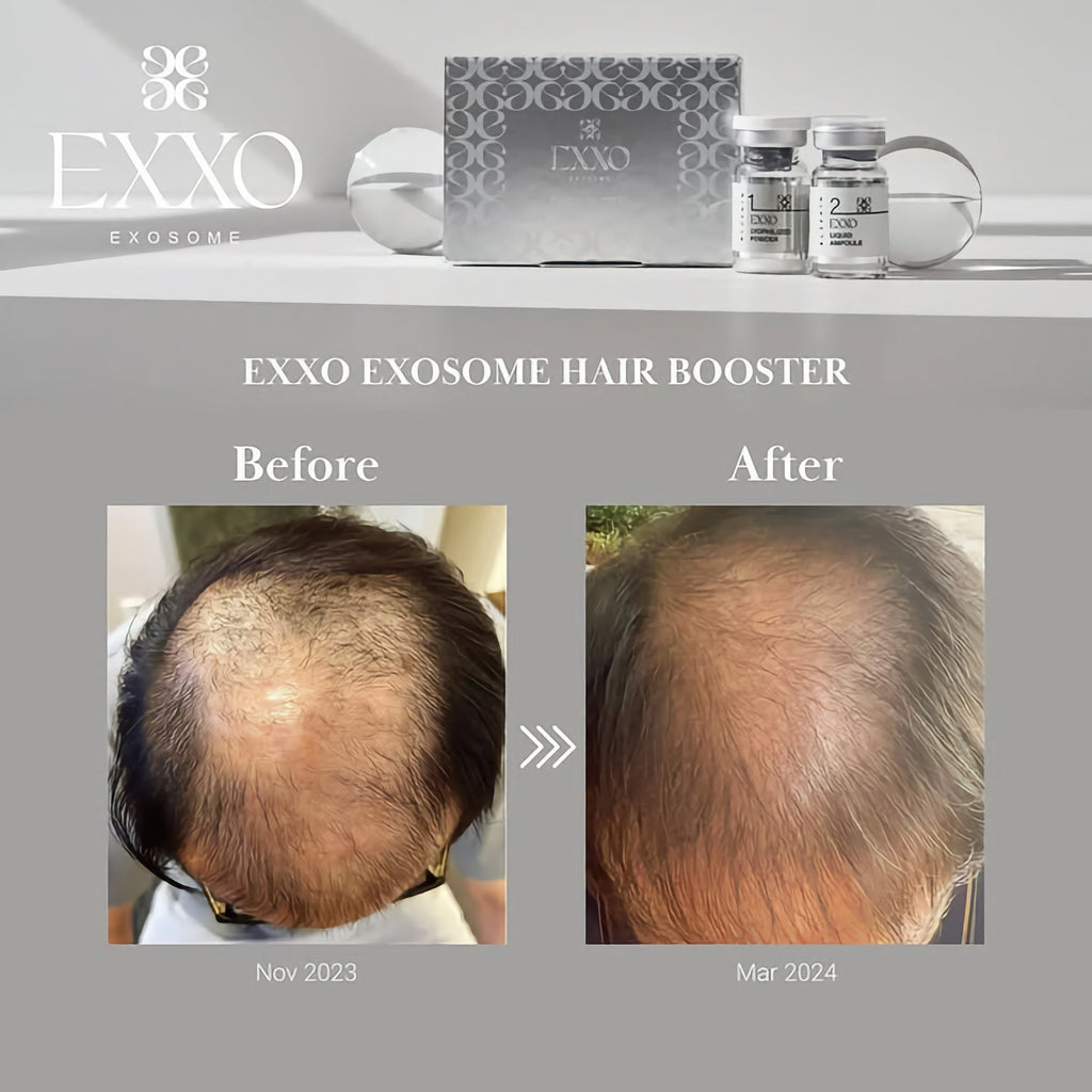 BLESKIN EXXO Exosome Hair Booster (5 treatments) - Glo Skin Beauty UK&I