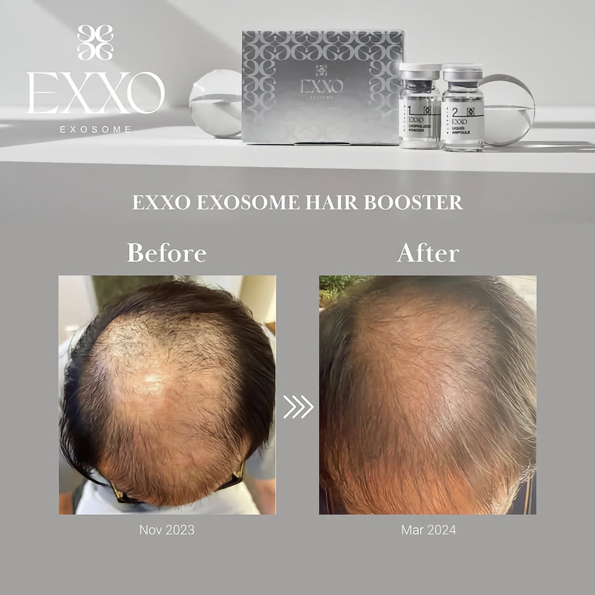 BLESKIN EXXO Exosome Hair Booster (5 treatments) - Glo Skin Beauty UK&I