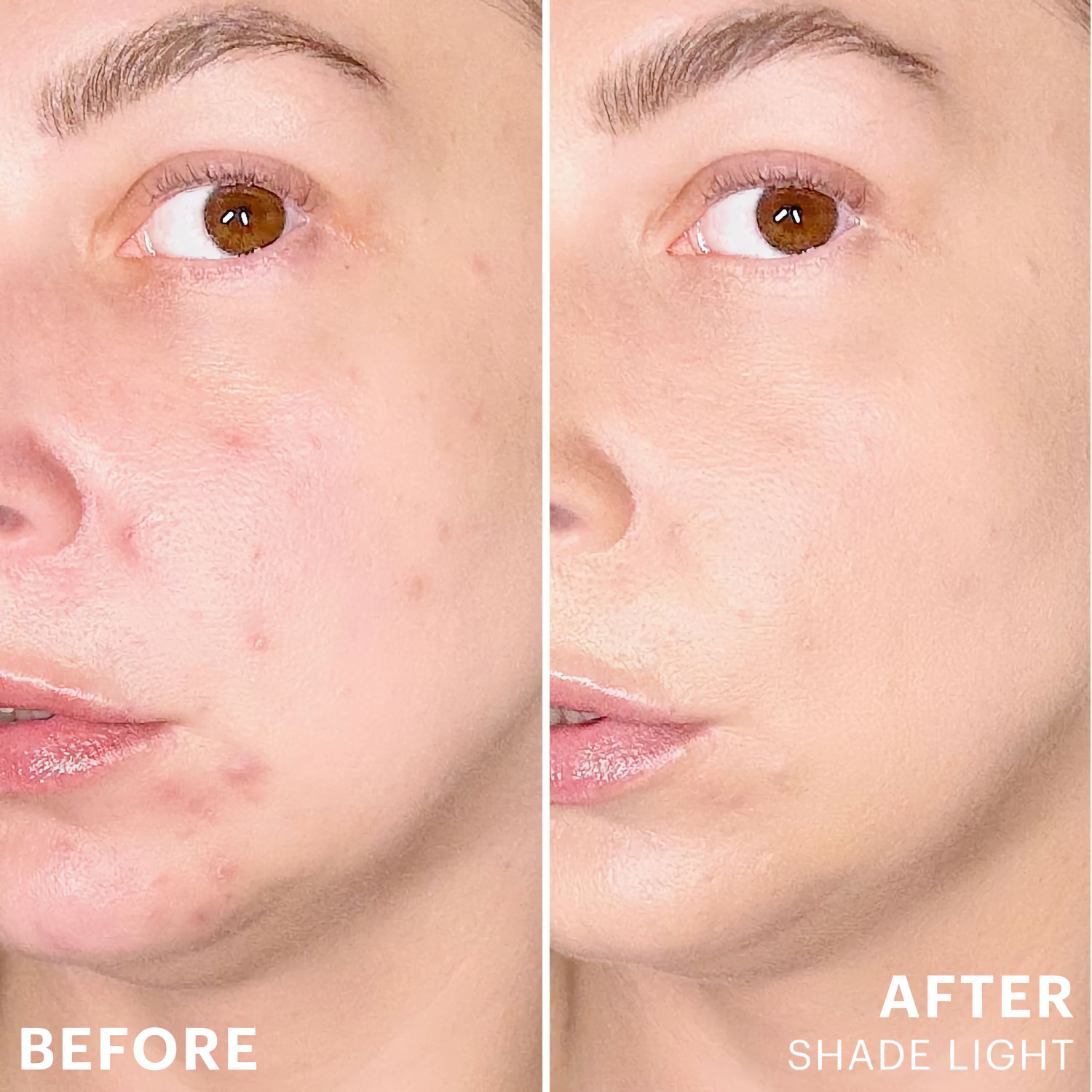 Glo skin Beauty Spot Treat Concealer before + after